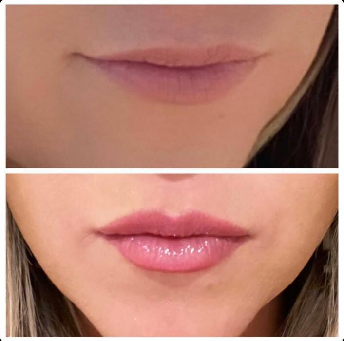 Images Blush Med Spa