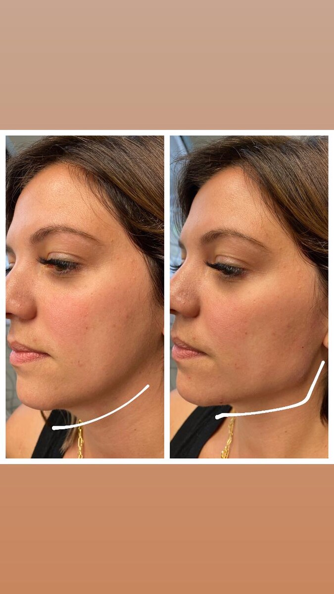 Images Blush Med Spa