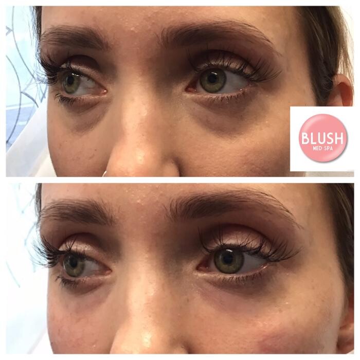 Images Blush Med Spa