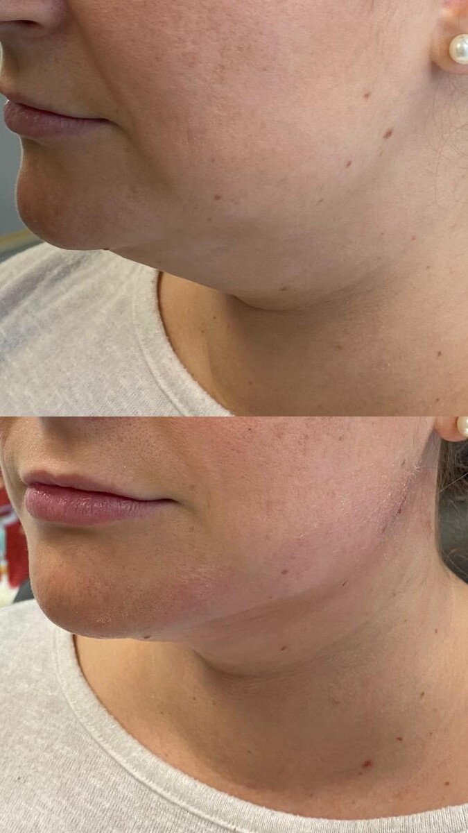 Images Blush Med Spa