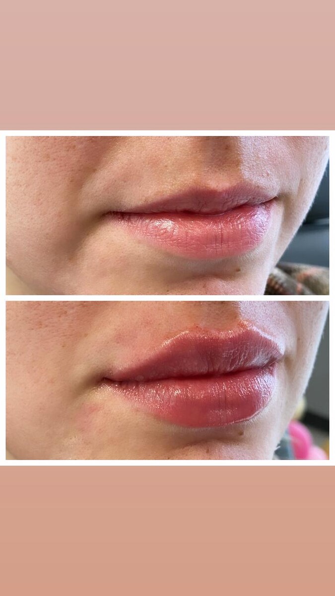Images Blush Med Spa