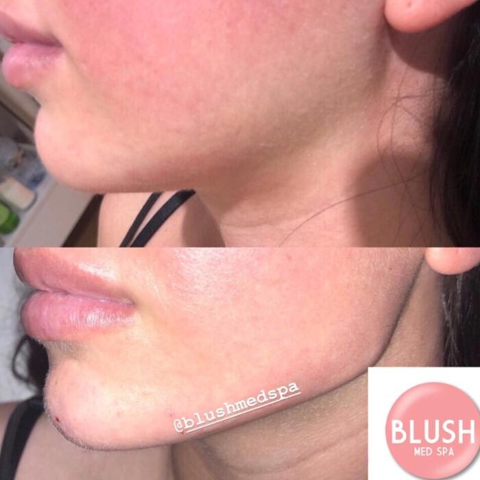 Images Blush Med Spa