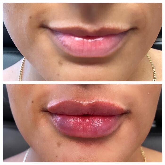 Images Blush Med Spa