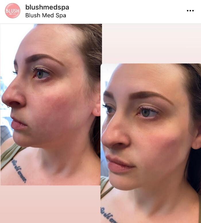 Images Blush Med Spa