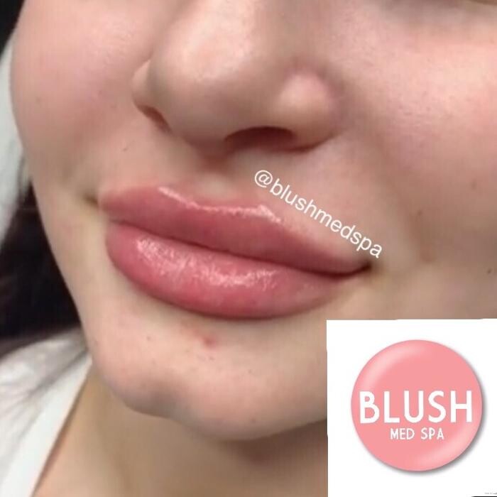 Images Blush Med Spa