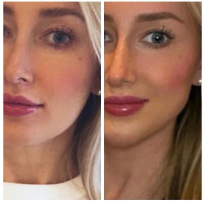 Images Blush Med Spa