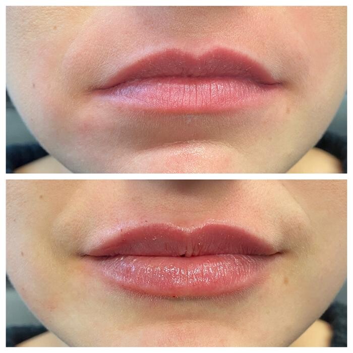 Images Blush Med Spa