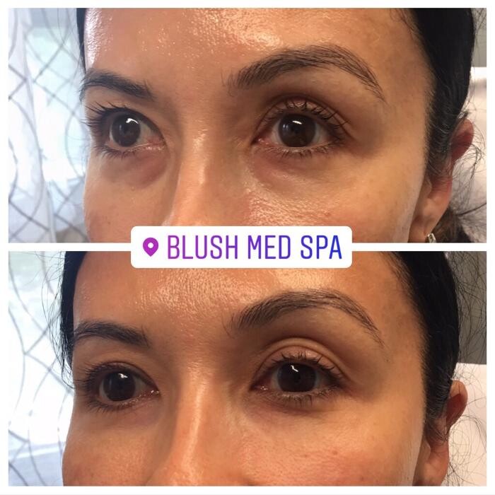 Images Blush Med Spa