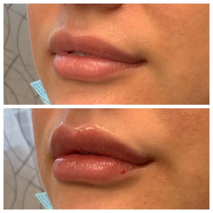 Images Blush Med Spa