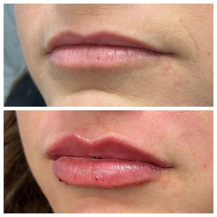 Images Blush Med Spa
