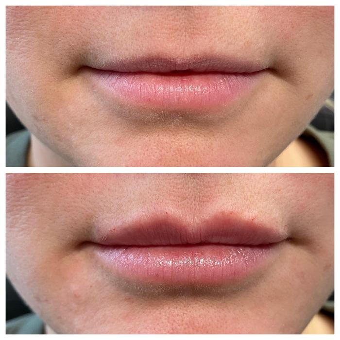 Images Blush Med Spa