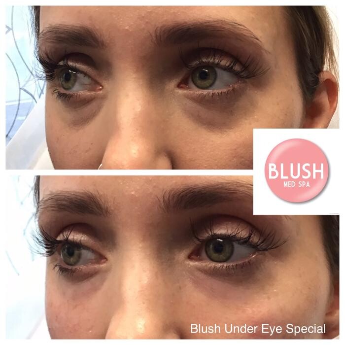 Images Blush Med Spa