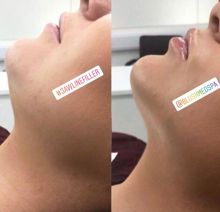 Images Blush Med Spa