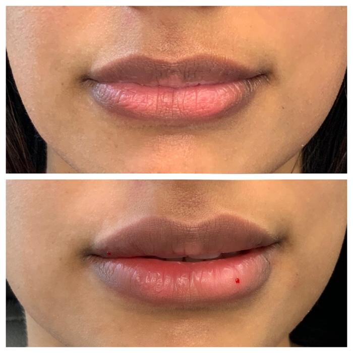 Images Blush Med Spa