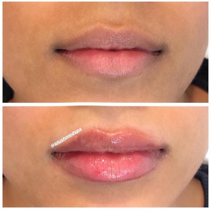 Images Blush Med Spa