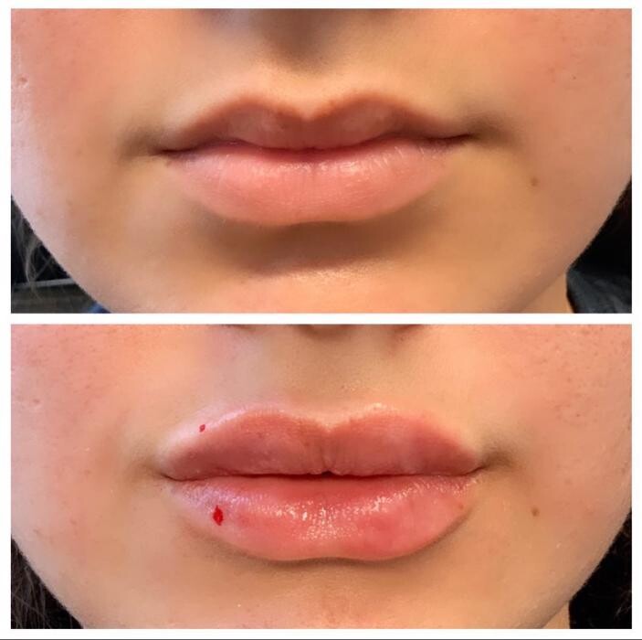 Images Blush Med Spa
