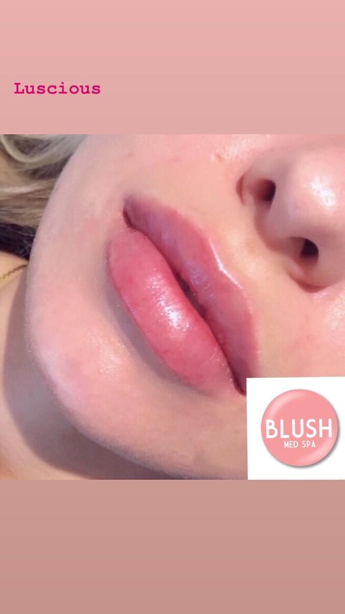 Images Blush Med Spa