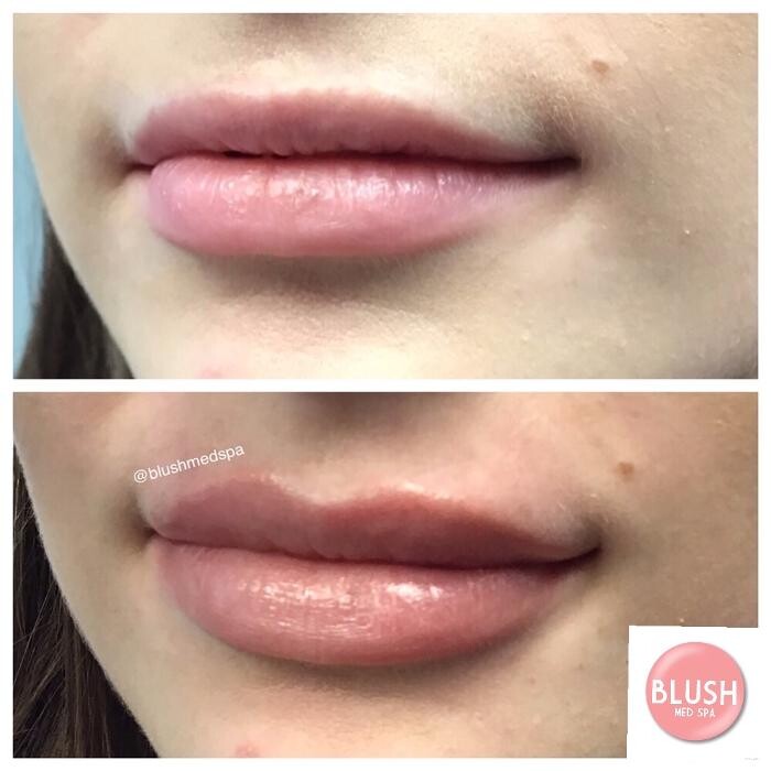 Images Blush Med Spa