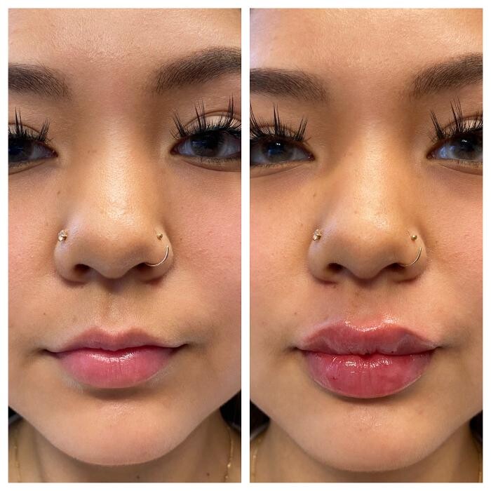 Images Blush Med Spa
