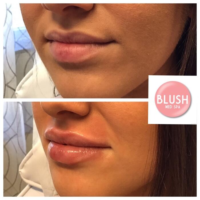 Images Blush Med Spa
