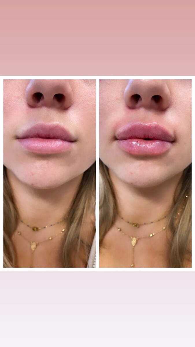 Images Blush Med Spa