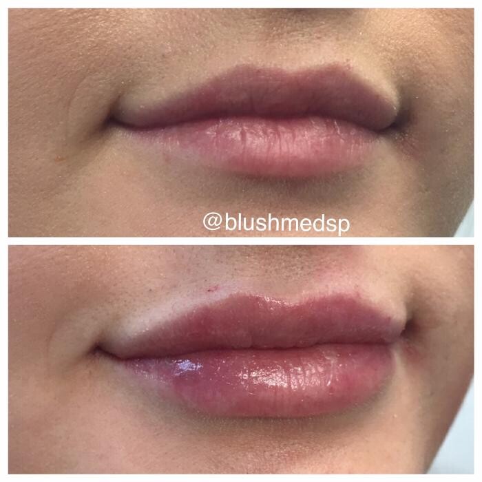 Images Blush Med Spa