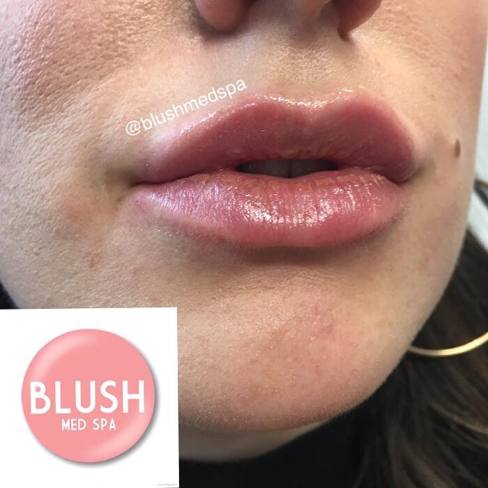 Images Blush Med Spa