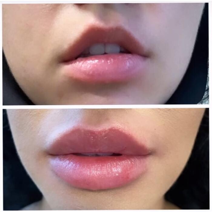 Images Blush Med Spa