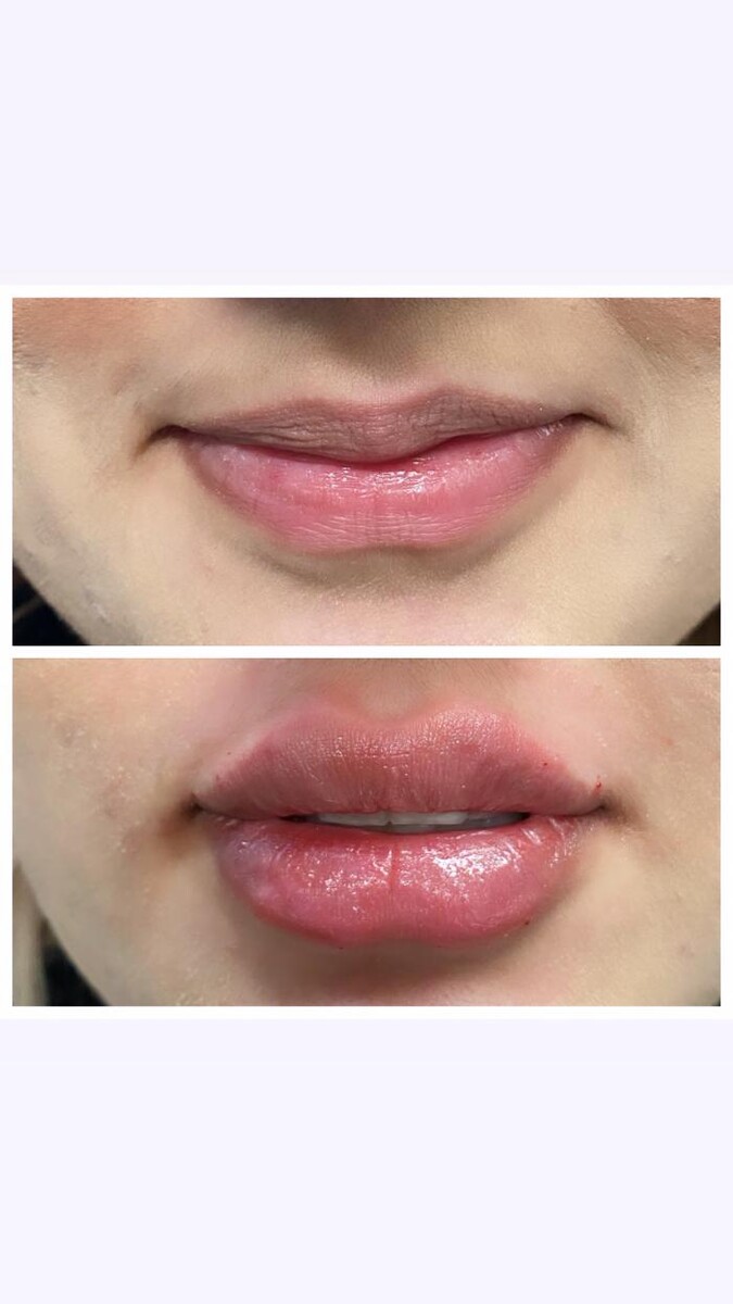Images Blush Med Spa