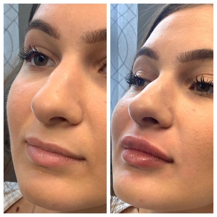 Images Blush Med Spa