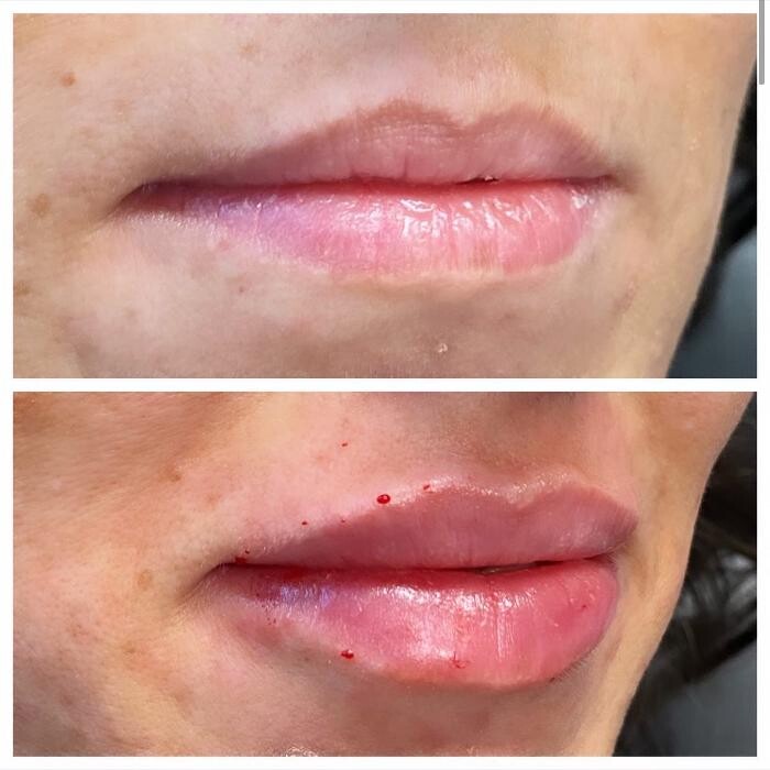 Images Blush Med Spa