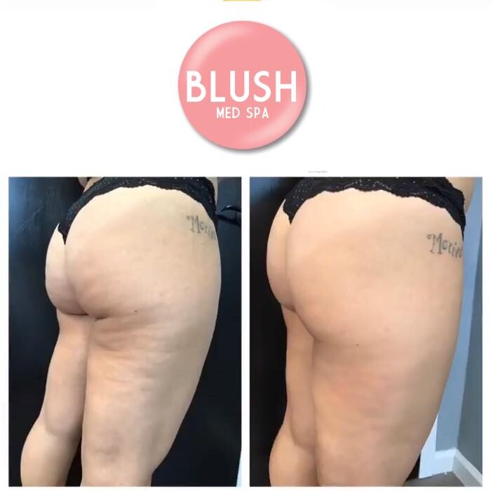 Images Blush Med Spa