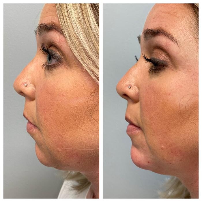 Images Blush Med Spa