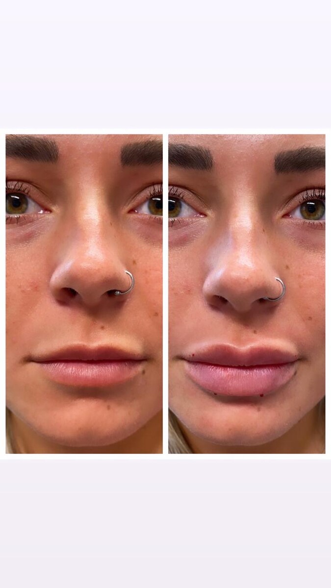 Images Blush Med Spa