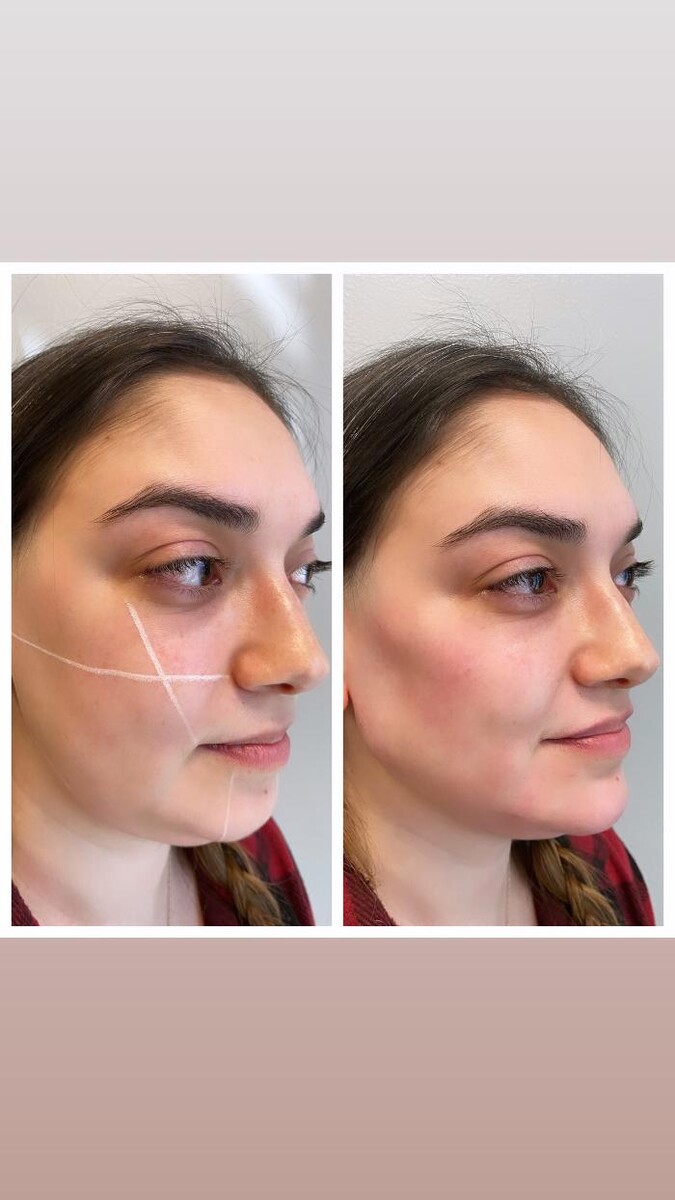 Images Blush Med Spa