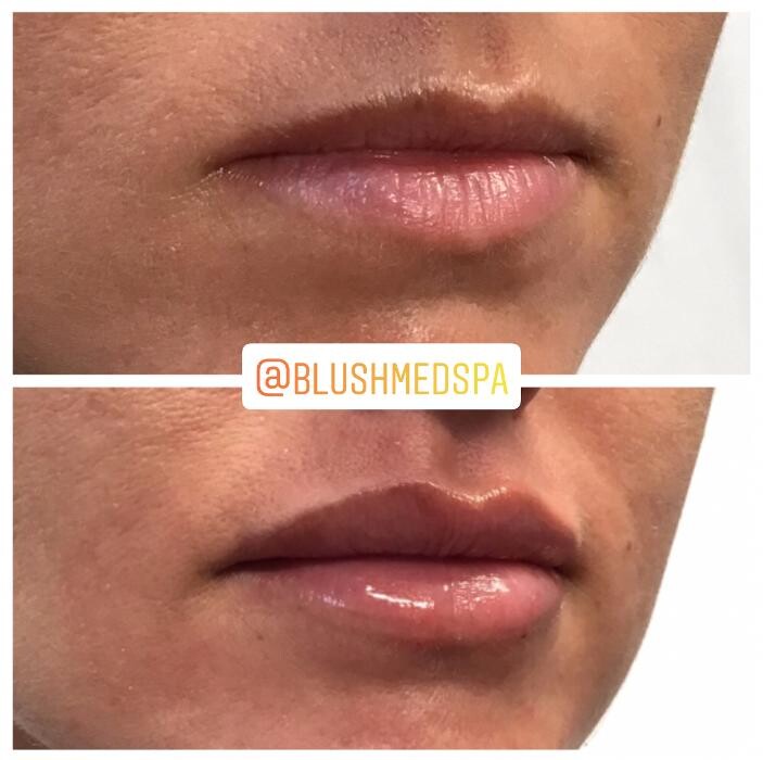 Images Blush Med Spa