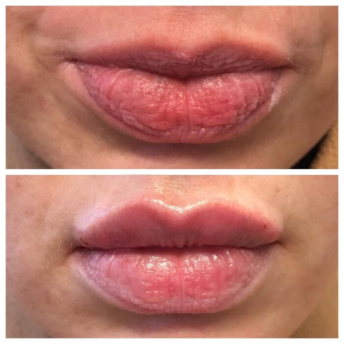 Images Blush Med Spa