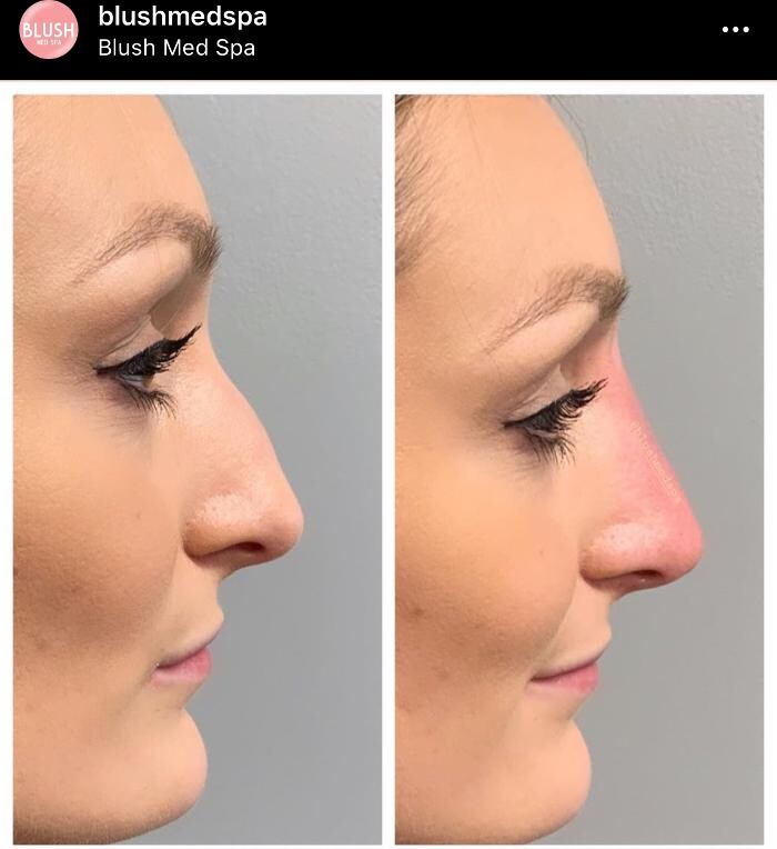 Images Blush Med Spa