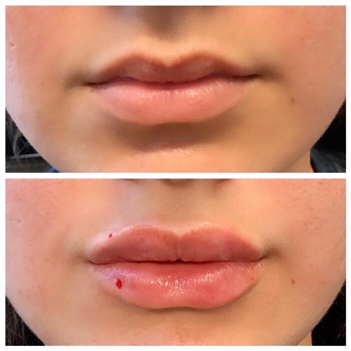 Images Blush Med Spa
