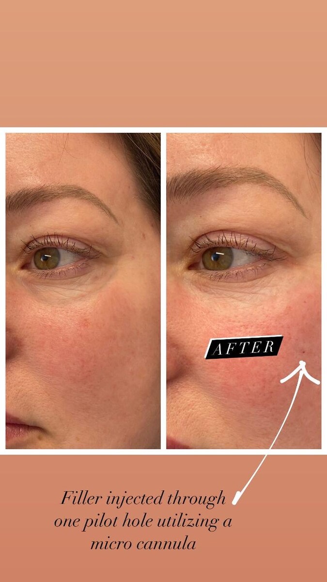 Images Blush Med Spa