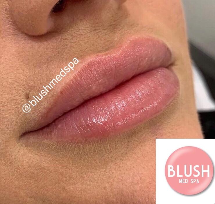 Images Blush Med Spa