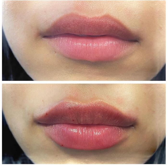 Images Blush Med Spa