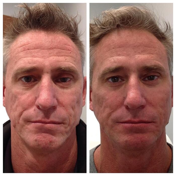 Images Glo Medspa