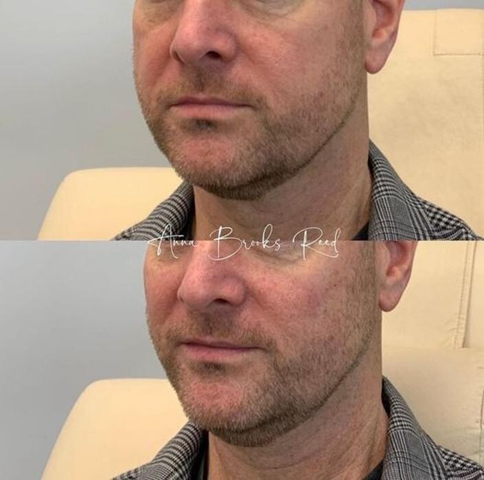 Images Glo Medspa
