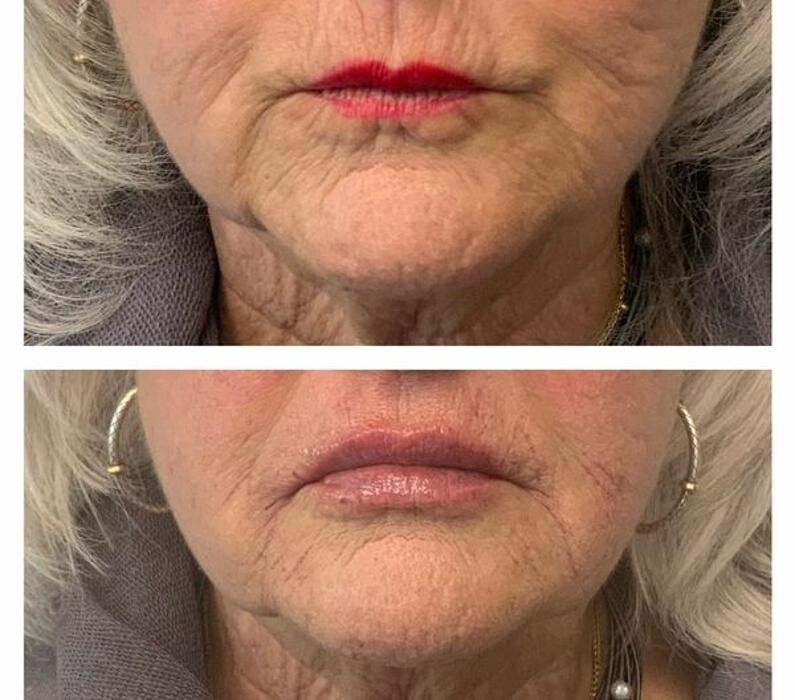 Images Glo Medspa