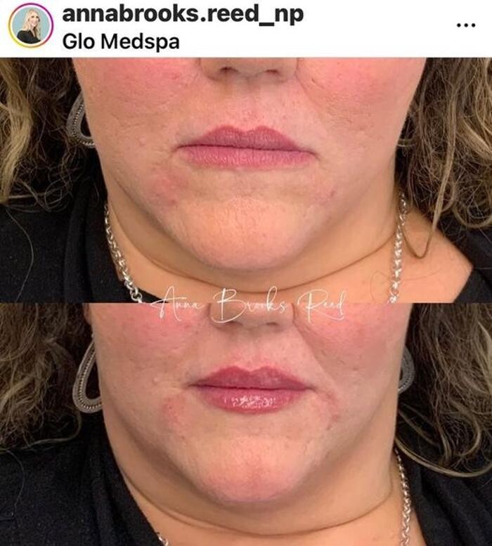 Images Glo Medspa