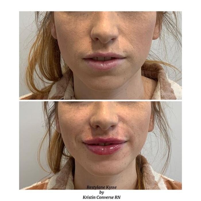 Images Glo Medspa
