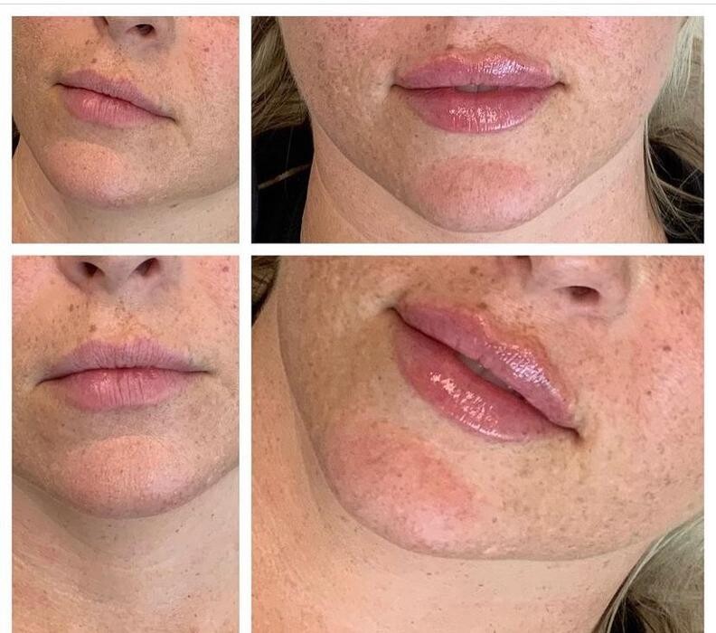 Images Glo Medspa