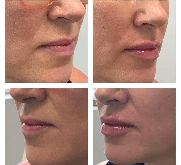 Images Glo Medspa