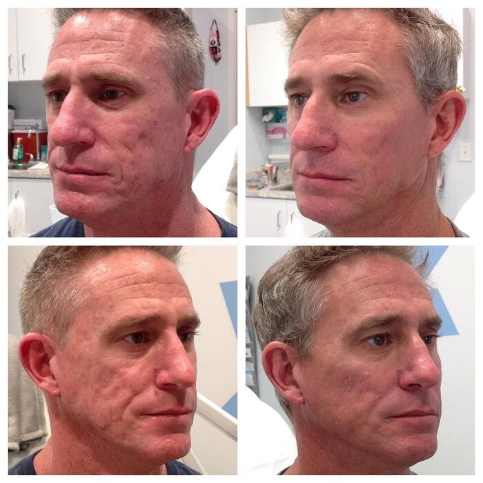 Images Glo Medspa